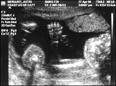 ultrasound terakhir